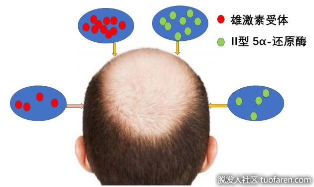 【圖】生物素對預防男性脱髮至關重要嗎