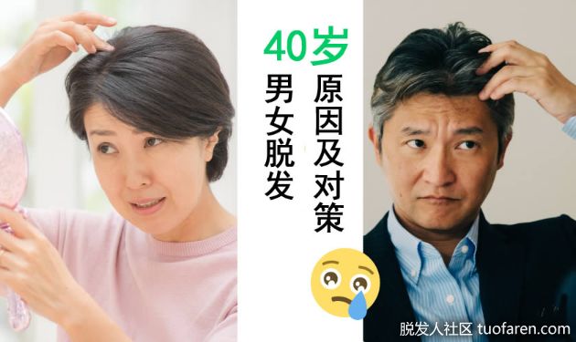 【圖】40歲男女脱髮的原因及對策