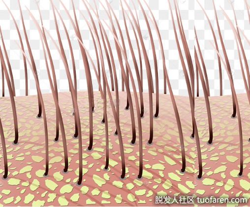 【圖】6種精油幫助去除頭皮屑