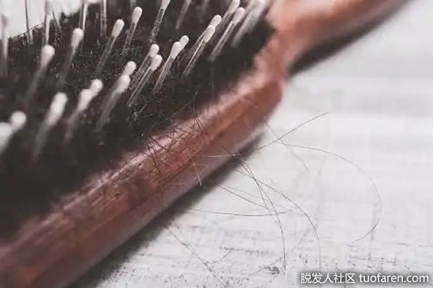 【圖】6種減少脱髮的自然療法