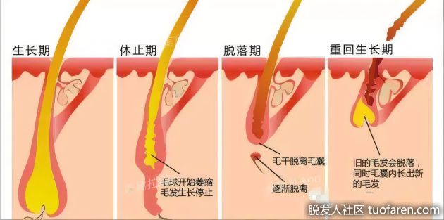 【圖】如果很多正常的頭髮突然脱落怎麼辦？懷疑休止期脱髮