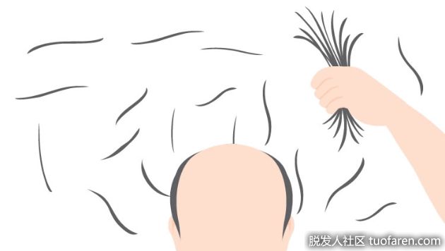 【圖】兒童和青少年脱髮的模式、原因和解決方案是什麼？