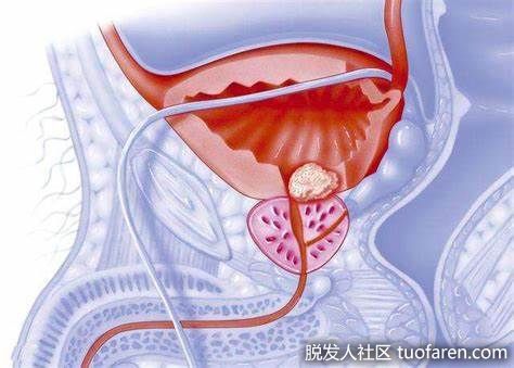 【圖】5種食物讓你的前列腺保持健康