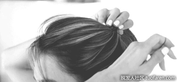 【圖】如果你有長頭髮，當心“牽引性脱髮”!