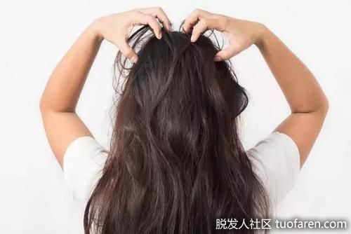 【圖】兩天沒洗頭了，頭皮有點刺痛……