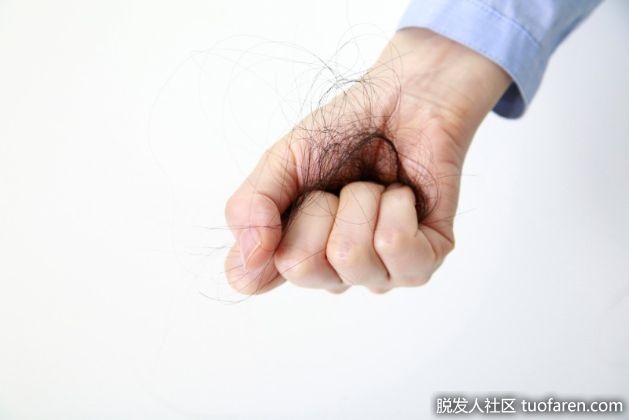 【圖】脱髮的原因和預防