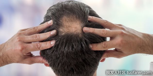 【圖】防止脱髮的6個“黃金時間”
