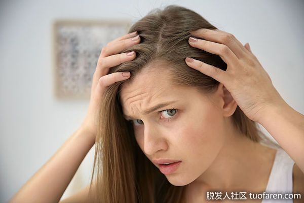 【圖】【推薦】脱髮人社區小編總結髮友10大頭髮問題