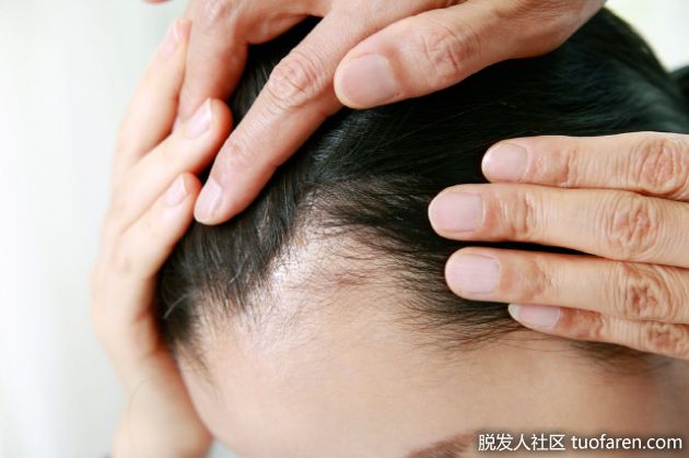 【圖】防止脱髮的“最重要”習慣是什麼？