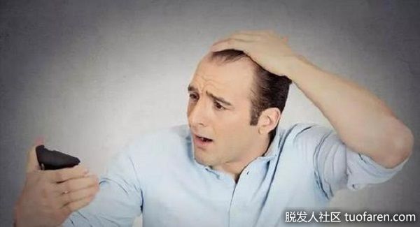 【圖】壓力大脱髮吃什麼營養的食物