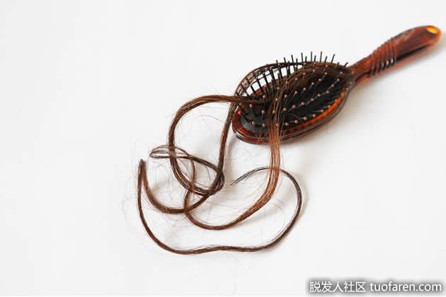 【圖】預防女性脱髮有效的方法是什麼？