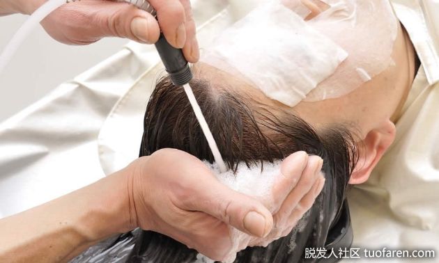 【圖】預防頭皮痤瘡和脱髮的治療和預防方法