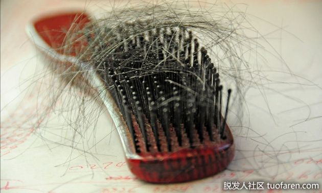 【圖】劉海脱髮的原因及預防