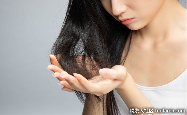 【圖】我不能吃脱髮藥...如何治療女性脱髮？