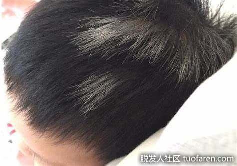 【圖】對白髮有用的食物