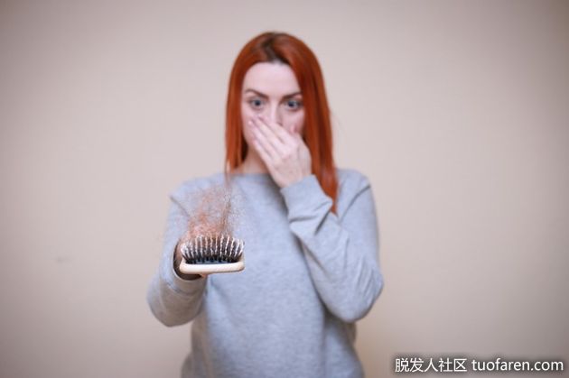 【圖】突然脱髮的原因以及您可以採取的措施