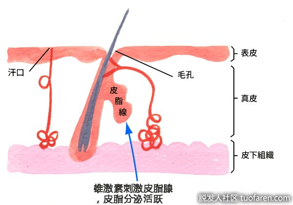 【圖】脂溢性脱髮可以停止的！