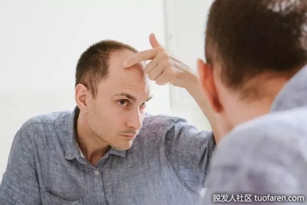 【圖】預防脱髮——如何有效阻止脱髮