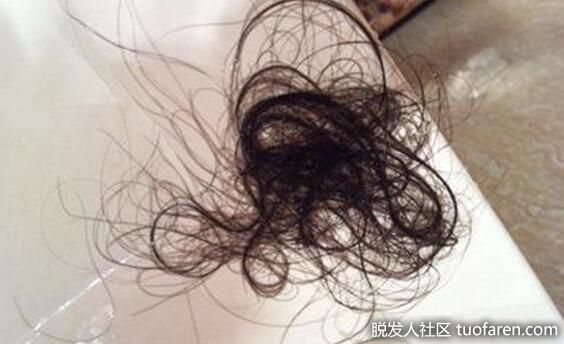 【圖】新生植髮：同樣是掉頭髮，為什麼自己的頭髮越掉越少