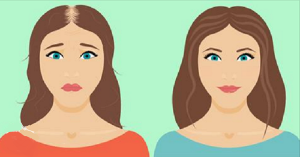 9種有助於防止和抑制DHT脱髮的食物