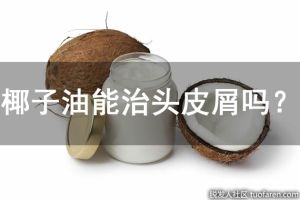 椰子油能治頭皮屑嗎？