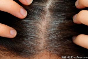 修復受損的毛囊