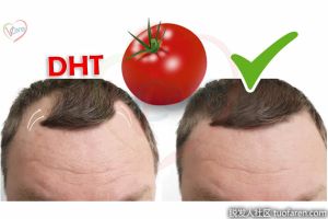 減少二氫睾酮水平的食物