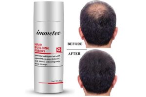 頭髮掉落及其背後的原因