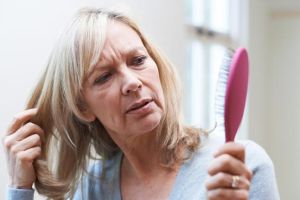 更年期脱髮治療