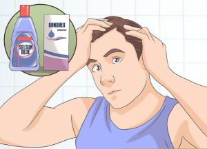 如何選擇最佳的脂溢性皮炎治療方法?