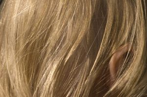 如何永久去除頭皮屑