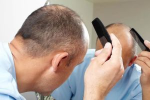 草藥治療可以防止禿頂、重新長出頭髮