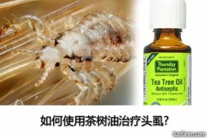 如何使用茶樹油治療頭蝨?