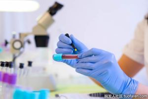 哪些食物會導致膽紅素水平升高？