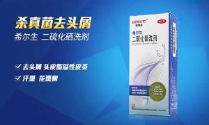 二硫化硒洗液對頭髮的作用及使用注意