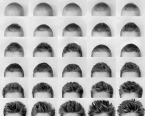 化療後頭髮會再生