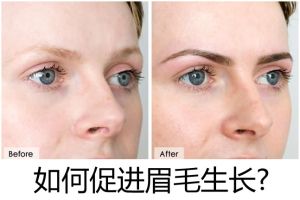 如何促進眉毛生長?