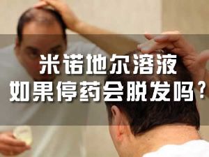 米諾地爾溶液如果停藥會脱髮嗎?