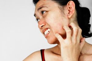 有什麼自然療法可以治療皮膚瘙癢?