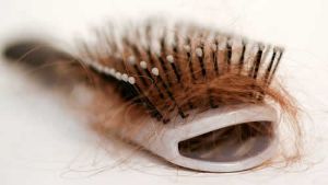 掉頭髮是什麼原因引起的