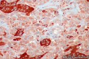 為什麼肌肉細胞有多個細胞核？