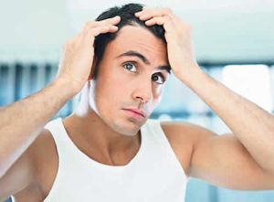 是什麼原因導致脱髮