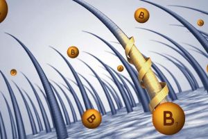 生物素能預防脱髮嗎?