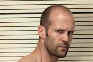 如何應對髮際線後退的問題？