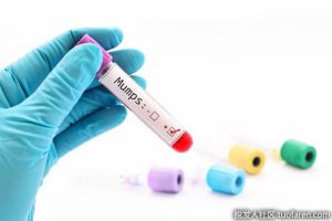 血液中葉酸含量高的原因是什麼？