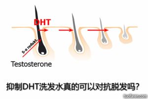 【組圖】抑制DHT洗髮水真的可以對抗脱髮嗎？