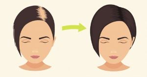 能用小蘇打洗頭嗎 教你小蘇打洗頭的方法