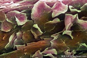 【組圖】真皮層細胞的功能是什麼？