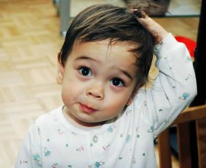 兒童脱髮的三點原因