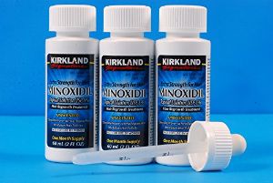 哪種Kirkland Minoxidil產品最好?